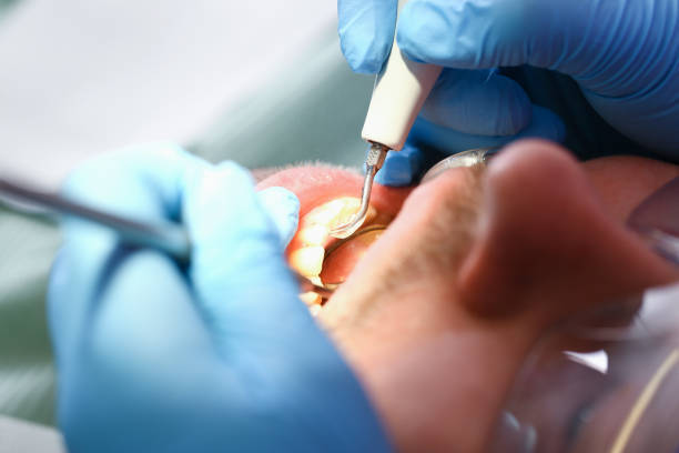 Best Chipped Tooth Repair Near Me  in Intercourse, PA